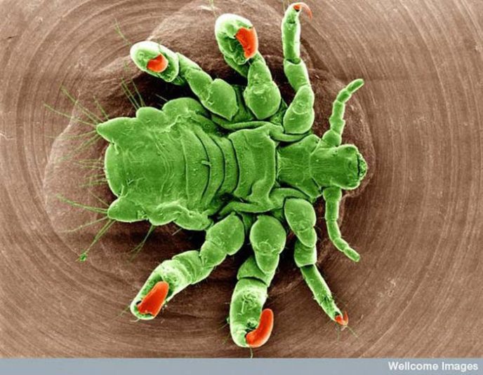Лобковая вошь - Обычные вещи под микроскопом