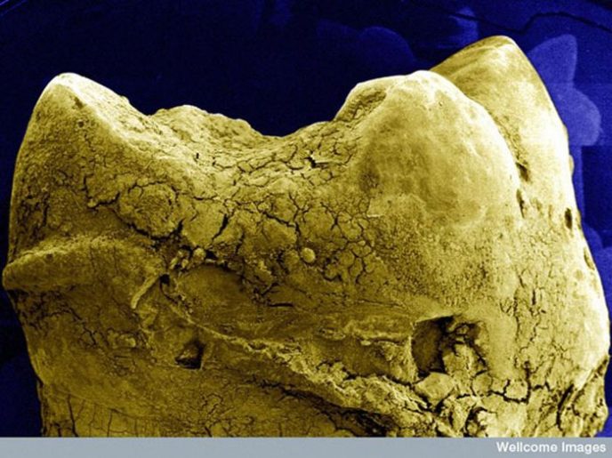 Поверхность зуба - Обычные вещи под микроскопом