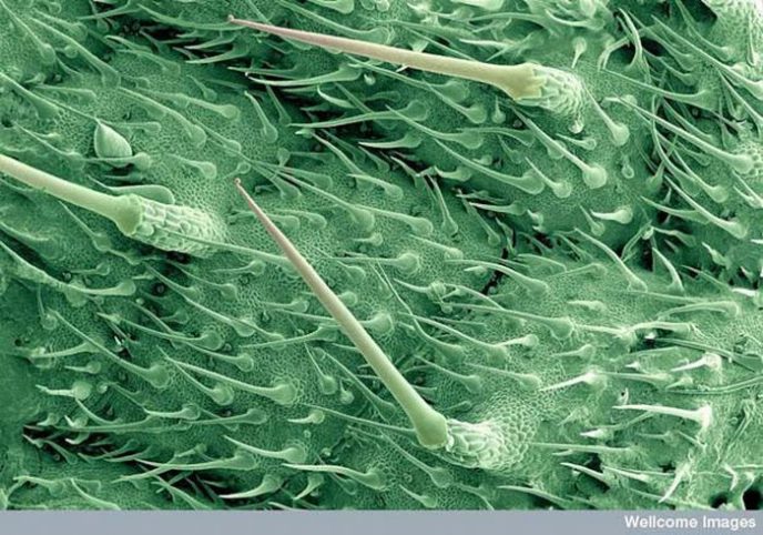 Жгучие волоски листьев крапивы - Обычные вещи под микроскопом