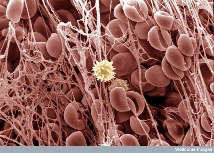 Сгусток крови - Обычные вещи под микроскопом