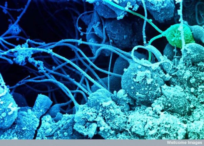 Сперматозоиды развиваются в семенниках - Обычные вещи под микроскопом