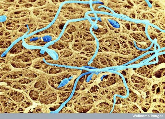 Сперматозоиды на поверхности яйцеклетки - Обычные вещи под микроскопом