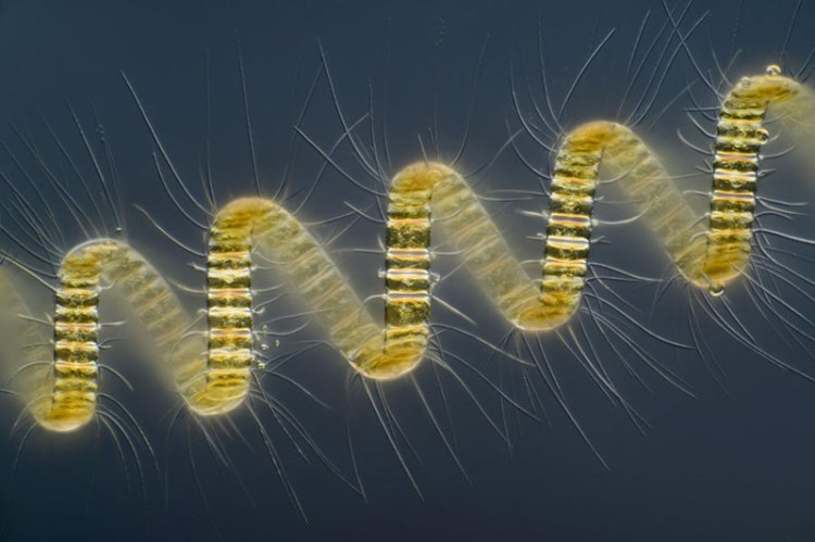 Колониальный организм планктона — Chaetoceros debilis - 30+ Фотографий под Микроскопом Колониальный организм планктона — Chaetoceros debilis - 30+ Фотографий под Микроскопом