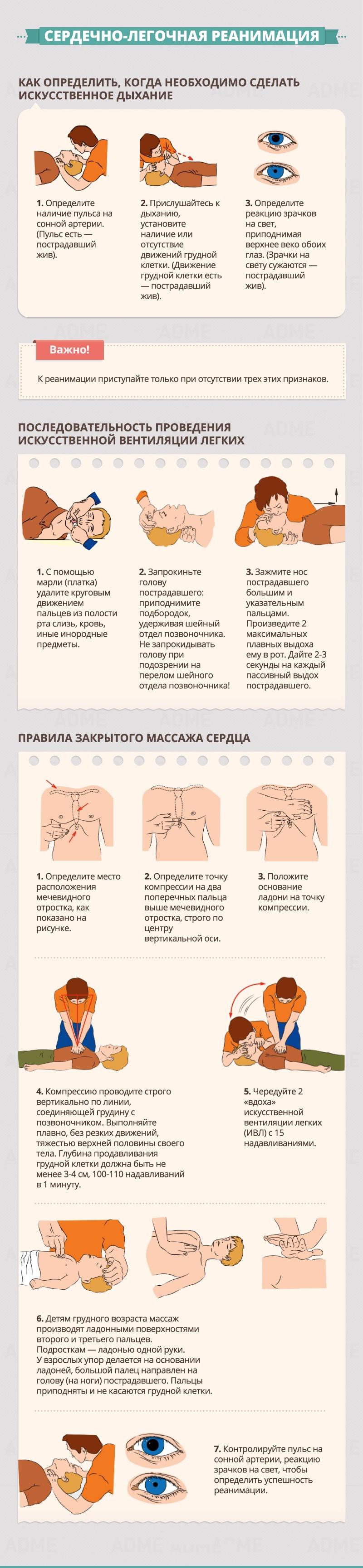 Сердечно-легочная реанимация - Гид по оказанию первой помощи