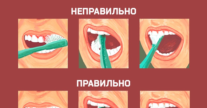Как правильно чистить зубы Как правильно чистить зубы