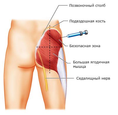 Как делать уколы дома