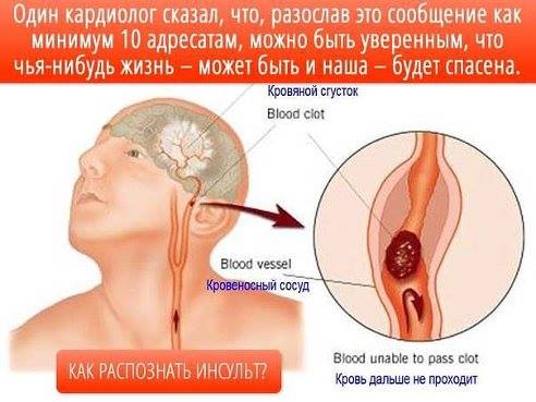 Распознование симптомов инсульта