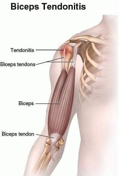 М'язові системи muscular-system65.jpg