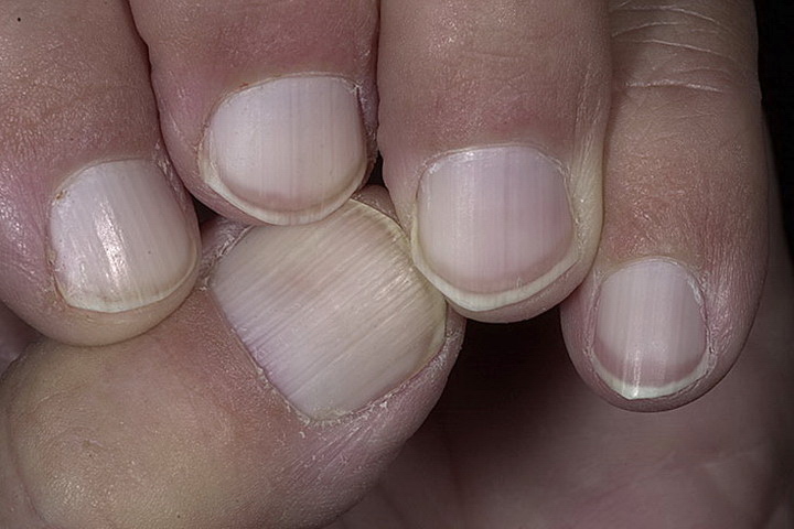 Белые ногти с розовыми полосками