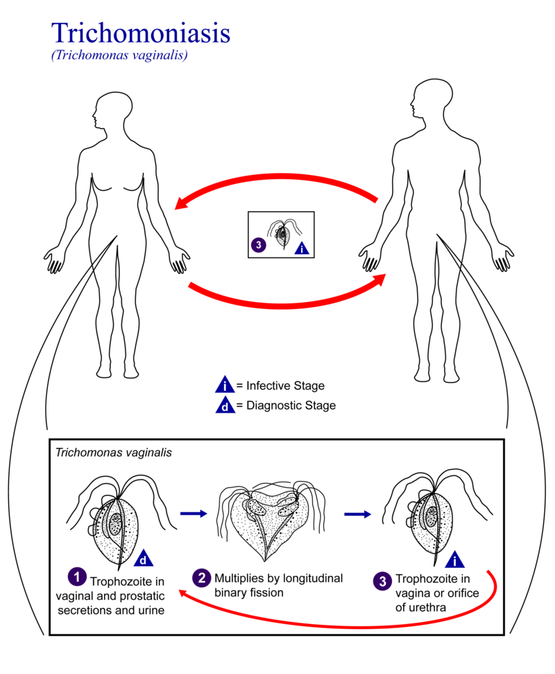 Trichomoniasis 01 Trichomoniasis 01