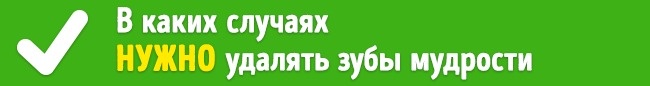 Нужно ли на самом деле удалять зубы мудрости? Удалять или нет зубы мудрости
